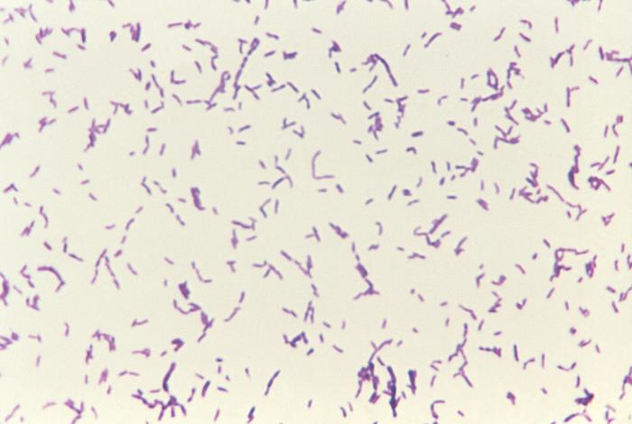 spirochetes gram stain